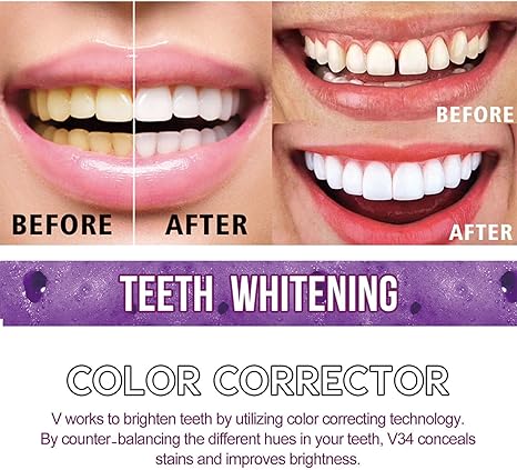Toothpaste for Teeth Whitening 😁😁😀