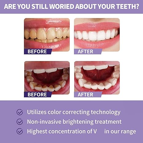 Toothpaste for Teeth Whitening 😁😁😀